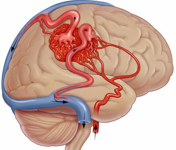 Cосудистое нейрохирургическое отделение